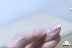 月牙大小、指甲竖纹，“观甲识病”靠谱吗？图片