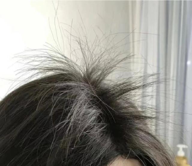 男子坚持使用"苗家生发秘方",5个月后头发全没了(生发液一个月可以长