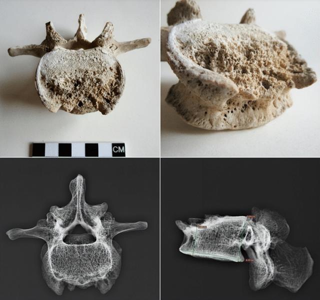 科学家首次对维苏威火山喷发受害者的基因组进行了完整测序