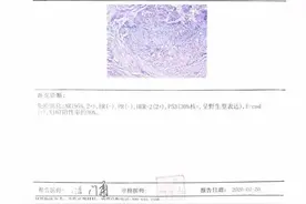 北京培元肿瘤医学研究院马大军：如何解读乳腺癌病理报告？图片