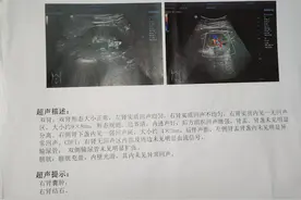 我的肾下盏结石，昨天终于动了，为了照顾他，昨晚失眠了图片