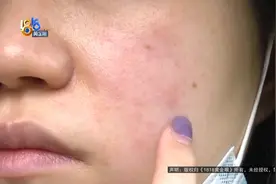 脸红像“煮熟的龙虾” ， “美嘉”有自己的态度图片