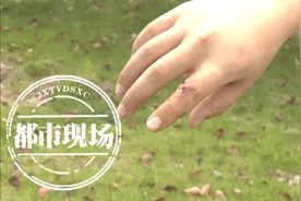 暑期打工第一天 大学生意外受伤图片