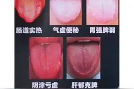 5种便秘类型看看你是哪一种，如果还没有你的，给我留言图片