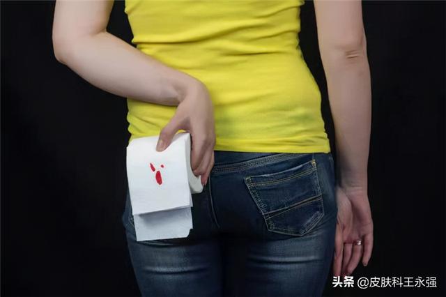 宫颈癌非角化性