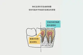 牙齿美白，有偏方、有科学，你知道其中的原理吗？图片