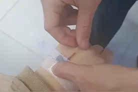 辽宁女子去输液偶遇实习护士男友，拔针那一刻：多少带点私人恩怨图片