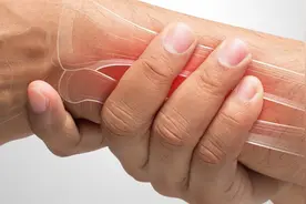 手指肿痛僵硬、有结节，预示着哪些疾病？医生指出常见的3种病因图片