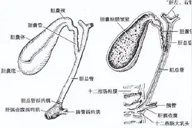 胆结石患者：纠结！遍地是“阳”，我结石咋个医？图片