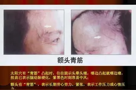 额头上的血管凸起来，影响美观，什么原因，怎么应对呢？图片