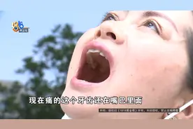 疼的是这颗牙，怎么拔了旁边那颗图片