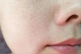 水初语护肤小知识丨毛孔粗大不只是因为皮肤油，还有这些原因……图片