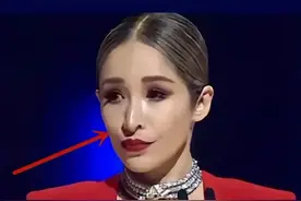 萧亚轩变形记，从潇洒小姐到“科技脸”，她那么美为何还痴迷整容图片