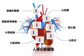 心磁图仪——心脏健康的守护者图片