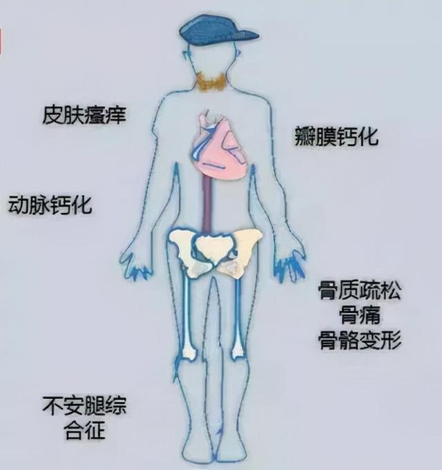 我不会强迫孩子喝饮料，但这几种还是少让孩子喝吧