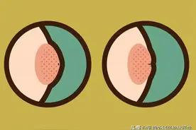 警惕！身体出现这5种症状，可能是乳腺癌图片