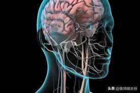 医生提醒：脑出血前的3大征兆要记牢，提前发现能救命，别忽视！图片