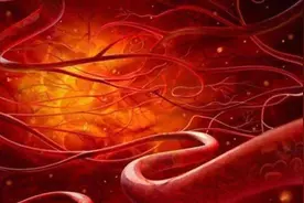 日本研究发现：血管变硬的原因，或与早餐有关，建议早了解图片