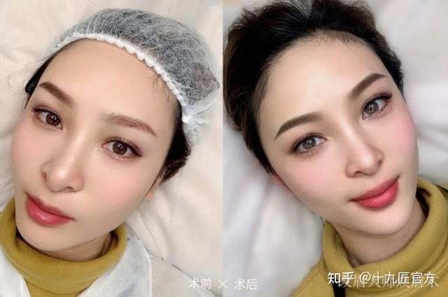 雾眉，线条眉和丝雾眉有什么区别呢？