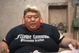 8大吃播就这样写下了结局：有人为保命减肥，有人变声、牙齿脱落图片