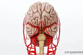 颈动脉有斑块，会有哪些症状？应该如何治疗？图片