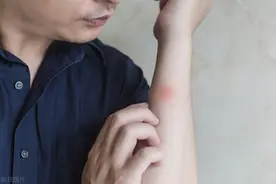 皮肤无故发痒千万别忽视，可能是这8种疾病！最后一个最可怕图片