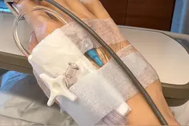 51岁李嘉欣入住ICU抢救48小时，脸部浮肿严重完全认不出图片