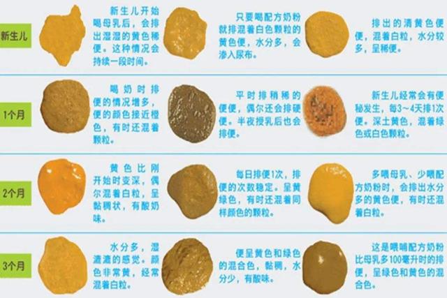 第5种:奶瓣便便比较常见于奶粉喂养的孩子,因为奶粉中的蛋白质孩子不