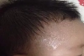 孩子出汗多到底正不正常，一招教你判断图片