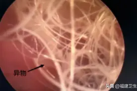 福州6岁女童下体出血1个月，原因万万没想到…家有女孩的要注意图片