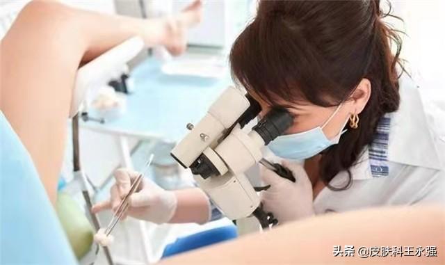 宫颈癌非角化性