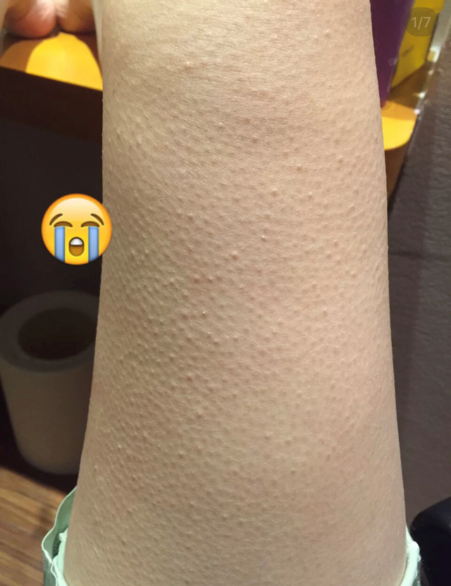 冬天身体乳需要全身涂么