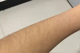 老人说：“男人无毛贵似金，女人有毛混半街”说的是什么意思？图片