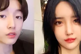 网红Abbily“变性”后发文感慨后遗症，半年了还在流血图片