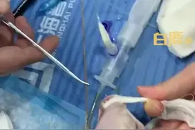 猫咪慢性呕吐2个月胃中塞满线绳图片