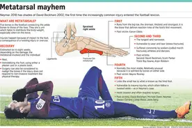 跖骨，足球不能承受之痛图片