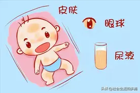 宝宝黄疸怎么办？正确去黄方法在此，建议速速收藏图片