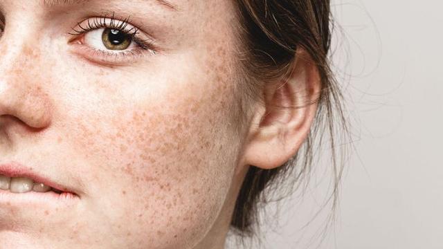 胶原蛋白流失,新陈代谢变慢,很少有人能梦想成真,而皮肤暗黄粗糙,长斑