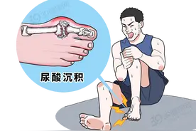 高尿酸会“祸害”身体多个器官，这6种食物，再爱吃也得管住嘴图片