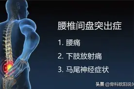 名医专访：注意！腰椎间盘突出，这几种运动不要做，避免加重病情图片