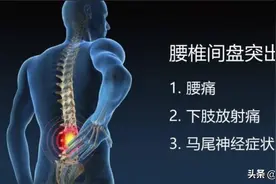 名医专访：注意！腰椎间盘突出，这几种运动不要做，避免加重病情图片