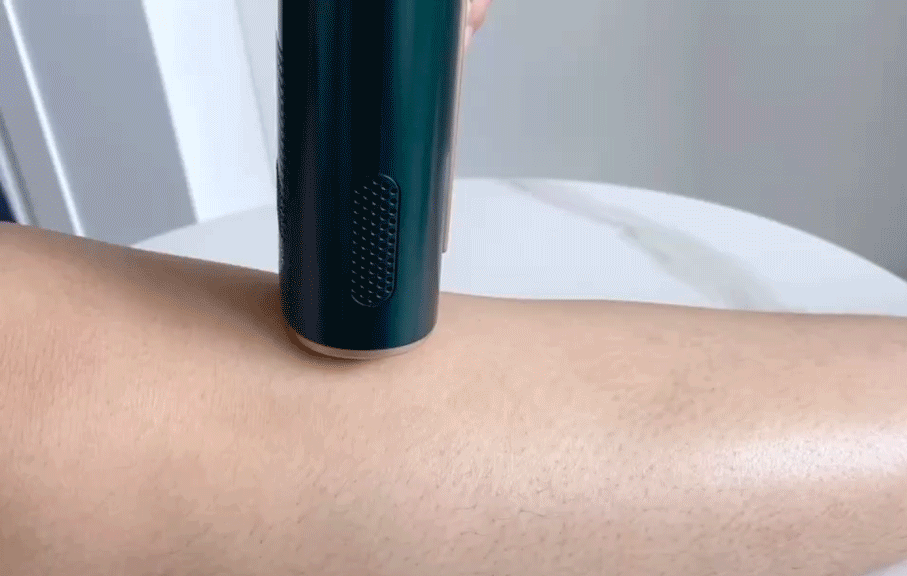 冰点脱毛以后可以擦身体乳吗