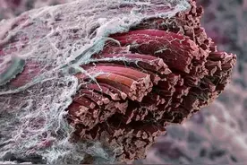 30张显微镜下拍摄的图片，带你以全新的角度去看待这个世界图片