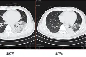 西南医院接诊一例“鹦鹉热”患者 专家提醒：接触禽类后需及时洗手图片