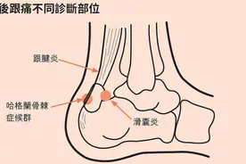后跟痛不等于足跟痛！图片