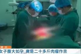 28岁未婚女子肚子发胖疯狂锻炼，检查后才发现腹内有22斤肉瘤图片