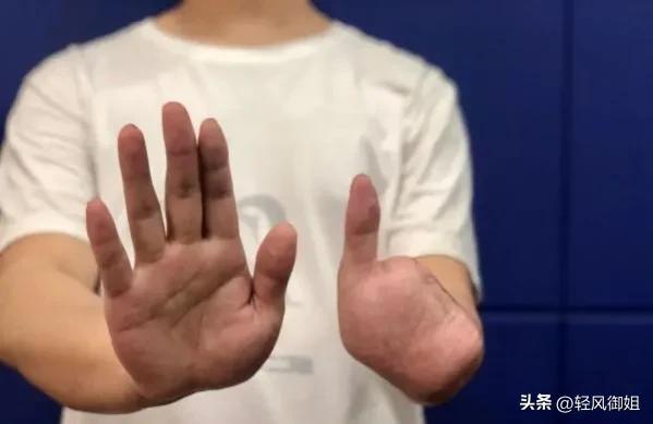 不要去缅北！诈骗卖淫割腰子有去无回，幸存者讲述生不如死的经历