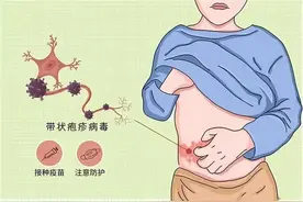 “带状疱疹”是怎么形成的？提议：坚持做好4件事，或可得到缓解图片