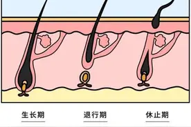 秃头星人的救星真的来了：体外培养毛囊类器官，成功率接近100%图片