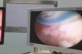 医生，B超提示我有子宫畸形，怎么办？图片